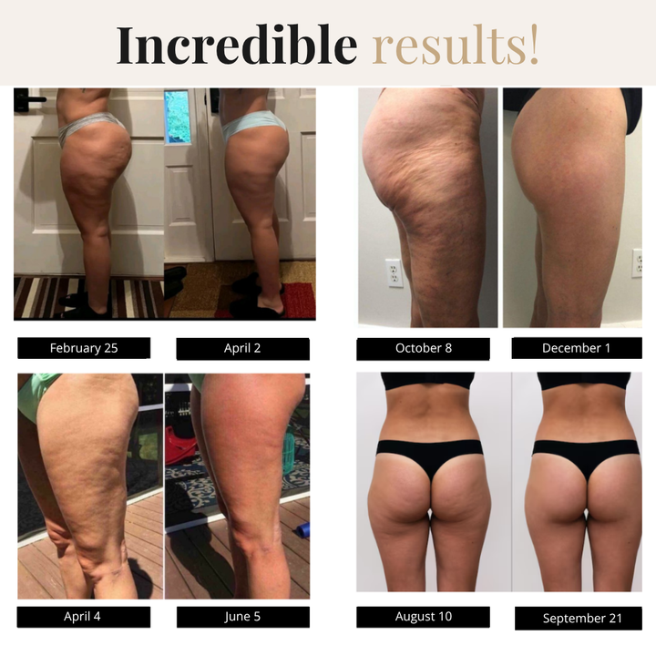 Rafall | High-Waist Performance Leggings